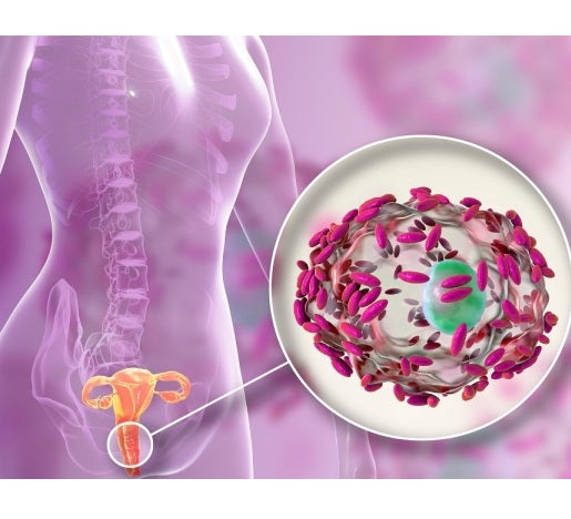 Test del Microbiota Vaginale Plus
